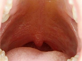 300人のおくち 第1集　サンプル画像06